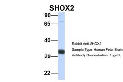 SHOX2 Antibody, Novus Biologicals 100 &mu;L; Unconjugated:Antibodies, Polyclonal